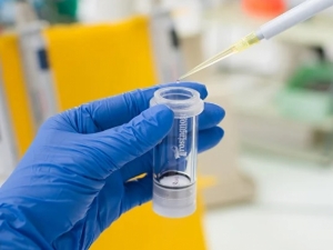 Exo:pure, набор для выделения экзосом из культуральной жидкости. Prostagnost