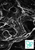 Фильтр, Митекс, d пор 10,0 мкм, d мембраны 13 мм, 100 шт., Merсk (Millipore)