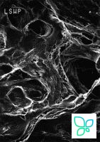 Фильтр, Митекс, d пор 5,0 мкм, d мембраны 47 мм, 100 шт., Merсk (Millipore)